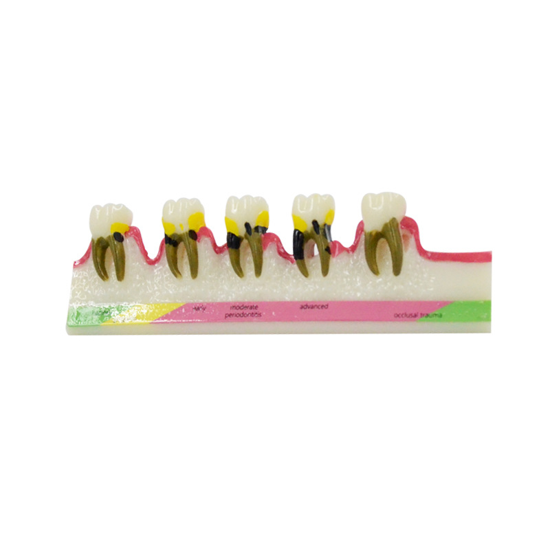 Medical Lab Study - Modello di malattia parodontale materiali dentali